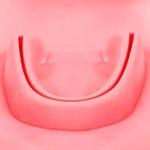 Simulador De Sutura 3d Dental/Oral Para Treino Ortho Pauher - Foto 4